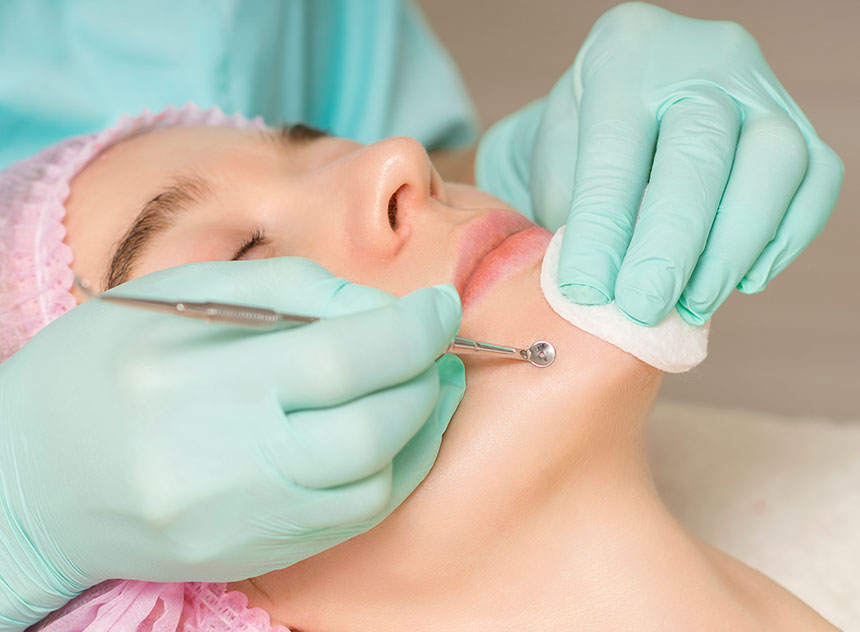 How To Get facial with extractions in Houston, TX?